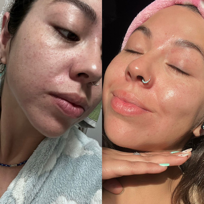 Renova+ – Piel Firme, Belleza Real