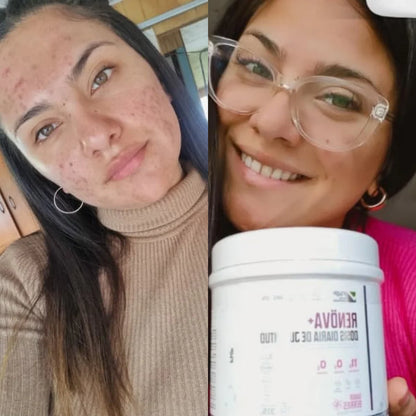 Renova+ – Piel Firme, Belleza Real